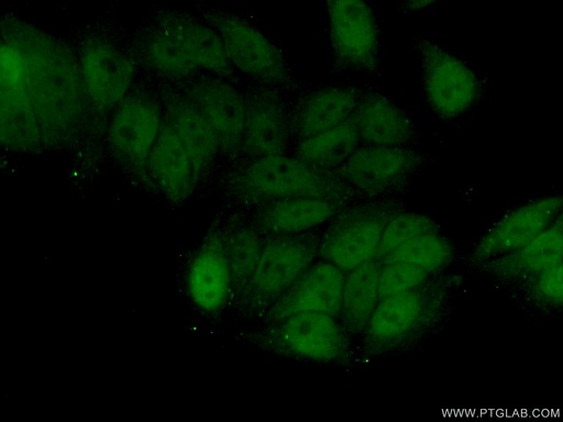 [25228-1-AP-150UL] ZNF451 Polyclonal antibody