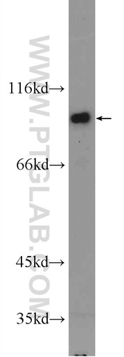 [25230-1-AP-20UL] IFT80 Polyclonal antibody