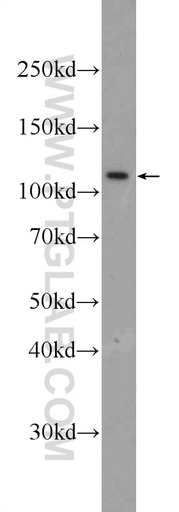[25234-1-AP-20UL] MYT1L Polyclonal antibody