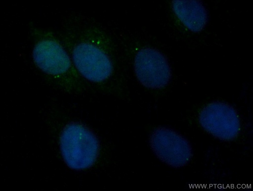 [25235-1-AP-20UL] CEP110 Polyclonal antibody