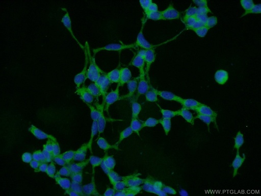 [25237-1-AP-20UL] COMMD8 Polyclonal antibody