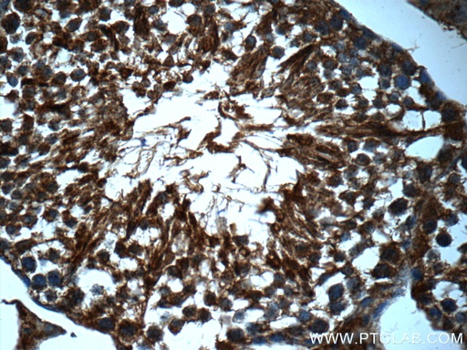 [25239-1-AP-150UL] TDRD5 Polyclonal antibody