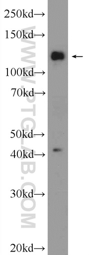 [25240-1-AP-150UL] FNDC3A Polyclonal antibody