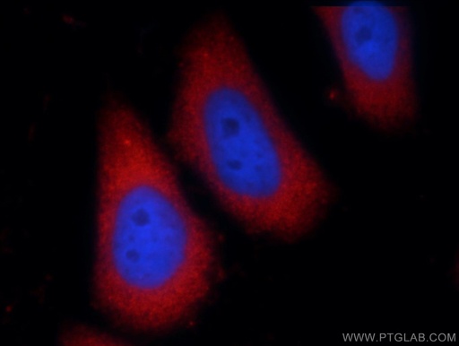 [25244-1-AP-20UL] PHLPPL Polyclonal antibody