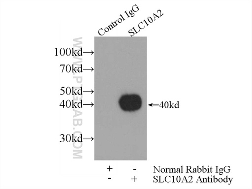[25245-1-AP-20UL] ASBT Polyclonal antibody