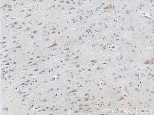 [25247-1-AP-20UL] GPR103 Polyclonal antibody