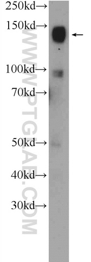 [25250-1-AP-150UL] CHL1 Polyclonal antibody