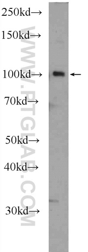 [25256-1-AP-150UL] SFMBT2 Polyclonal antibody