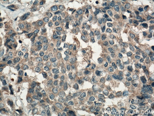 [25258-1-AP-20UL] FAM20A Polyclonal antibody