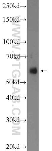 [25261-1-AP-150UL] VGLUT2 Polyclonal antibody