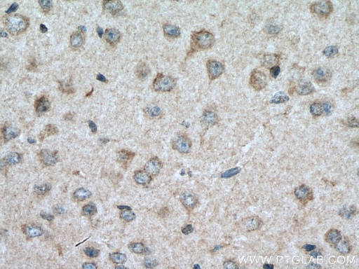 [25267-1-AP-20UL] CRHR2 Polyclonal antibody