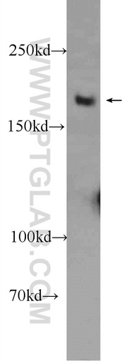 [25269-1-AP-150UL] WRN Polyclonal antibody