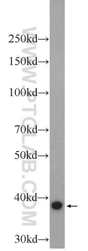 [25274-1-AP-20UL] FAM98C Polyclonal antibody