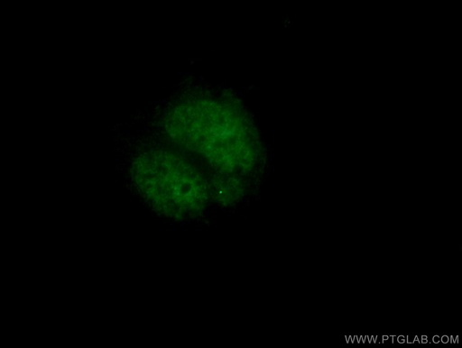 [25276-1-AP-150UL] PHOX2B Polyclonal antibody