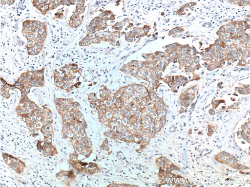 [25277-1-AP-150UL] Integrin Beta 4 Polyclonal antibody