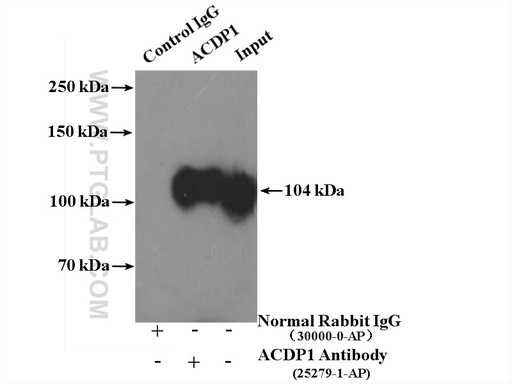 [25279-1-AP-150UL] ACDP1 Polyclonal antibody