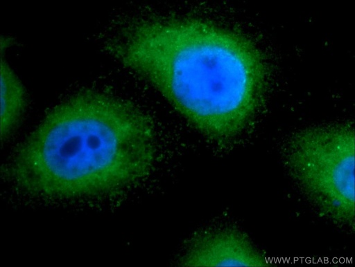 [25282-1-AP-20UL] TRAPPC2L Polyclonal antibody