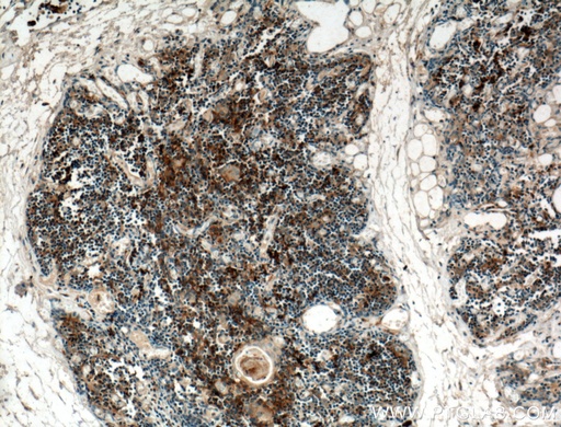 [25285-1-AP-150UL] CCL25/TECK Polyclonal antibody