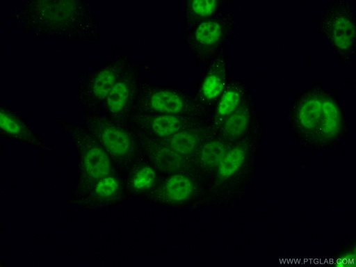 [25293-1-AP-150UL] CWC15 Polyclonal antibody