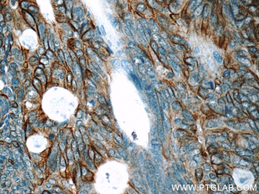[25296-1-AP-20UL] Claudin 23 Polyclonal antibody