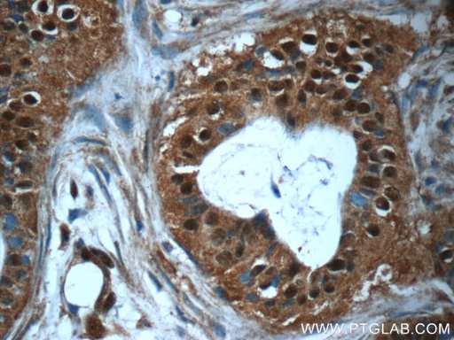 [25297-1-AP-150UL] RBM25 Polyclonal antibody