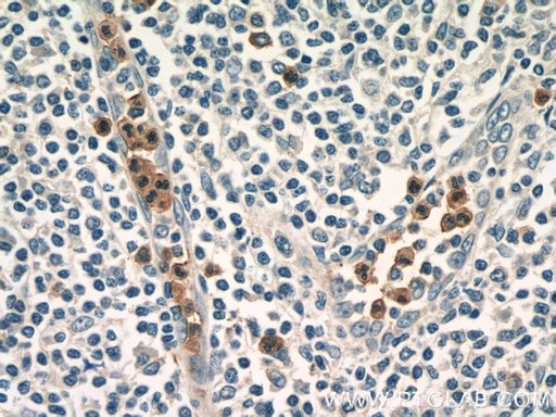 [25300-1-AP-150UL] ASB14 Polyclonal antibody
