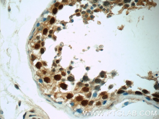 [25302-1-AP-150UL] ZNF571 Polyclonal antibody
