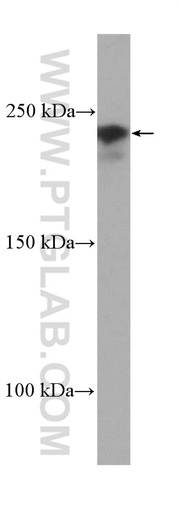 [25303-1-AP-150UL] TRIP12 Polyclonal antibody