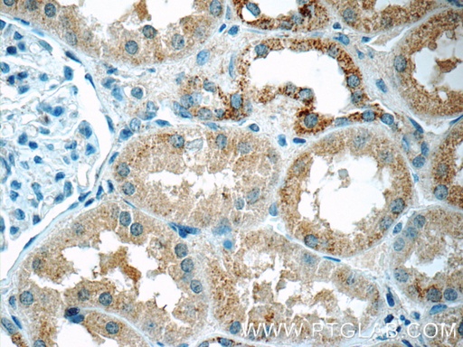 [25304-1-AP-20UL] DTX3 Polyclonal antibody
