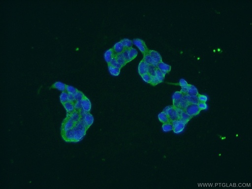 [25307-1-AP-150UL] EPRS Polyclonal antibody