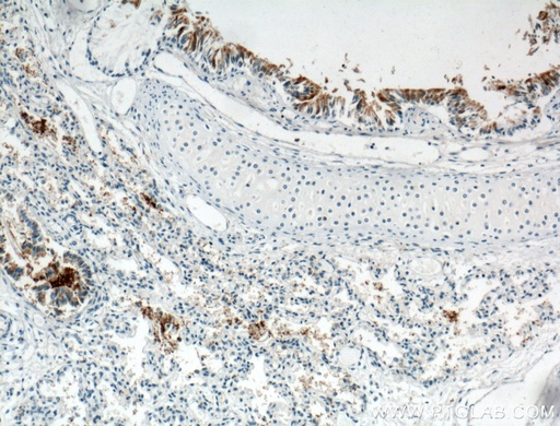 [25309-1-AP-150UL] PIH1D3 Polyclonal antibody