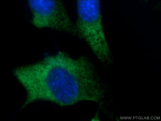 [25314-1-AP-150UL] FGF17 Polyclonal antibody
