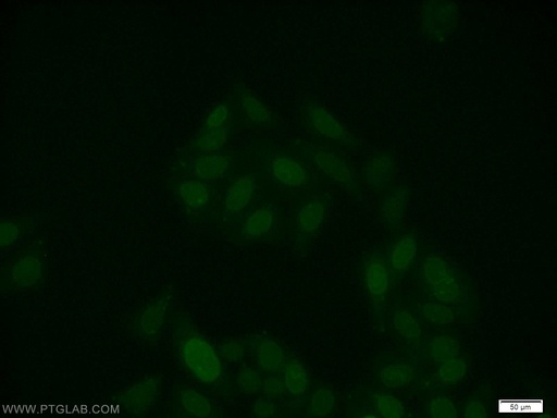 [25315-1-AP-20UL] RUNX1 (middle) Polyclonal antibody