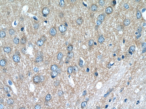 [25316-1-AP-150UL] ATP6V1G2 Polyclonal antibody