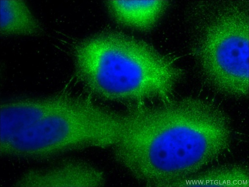 [25318-1-AP-150UL] Desmoplakin Polyclonal antibody