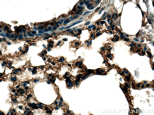 [25320-1-AP-150UL] EHD3 Polyclonal antibody
