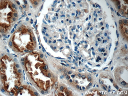 [25321-1-AP-150UL] IQSEC2 Polyclonal antibody