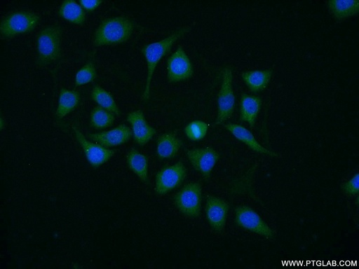 [25326-1-AP-20UL] DYNC1LI1 Polyclonal antibody
