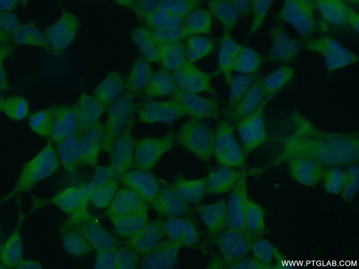 [25335-1-AP-150UL] CHD3 Polyclonal antibody