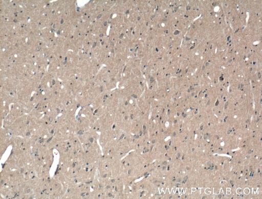 [25339-1-AP-150UL] ABCA7 Polyclonal antibody
