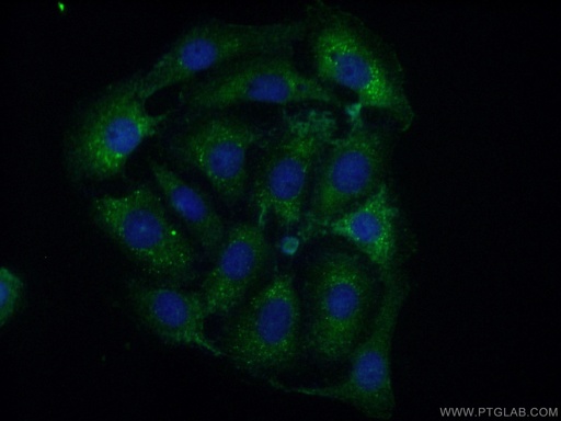 [25342-1-AP-20UL] CPEB4 Polyclonal antibody