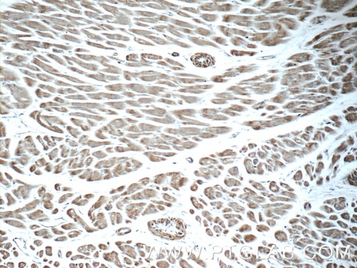 [25343-1-AP-150UL] AGTR1 Polyclonal antibody