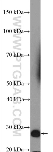[25348-1-AP-150UL] RSPO1 Polyclonal antibody
