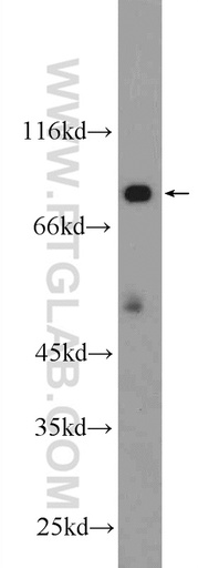 [25351-1-AP-150UL] HECTD2 Polyclonal antibody