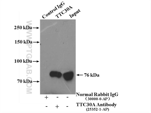 [25352-1-AP-150UL] TTC30A Polyclonal antibody