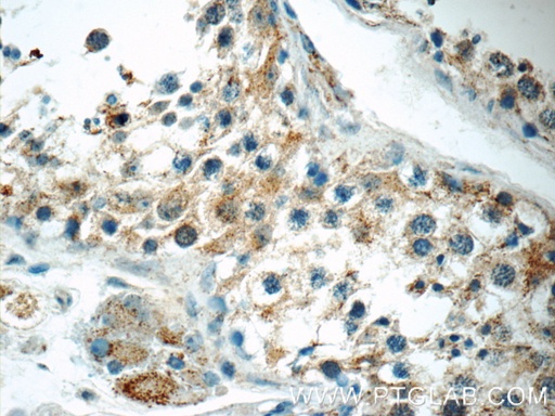 [25353-1-AP-150UL] TNRC4 Polyclonal antibody