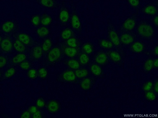 [25359-1-AP-20UL] SBNO1 Polyclonal antibody