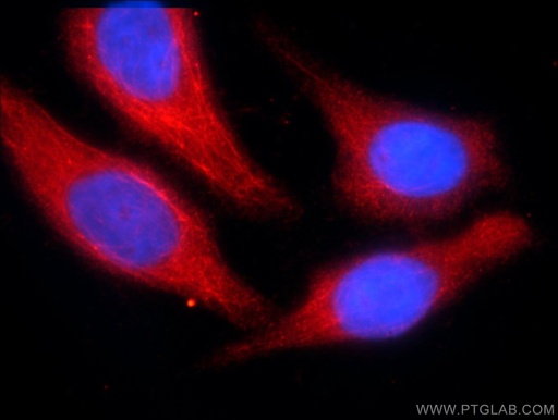 [25362-1-AP-150UL] C3orf43 Polyclonal antibody
