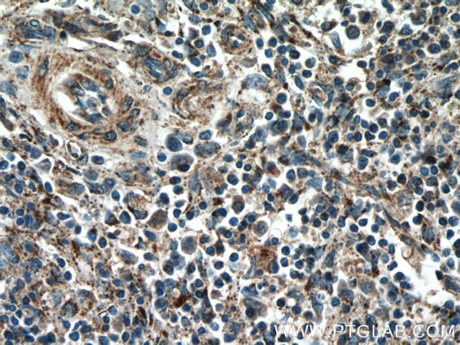 [25370-1-AP-20UL] YOD1 Polyclonal antibody