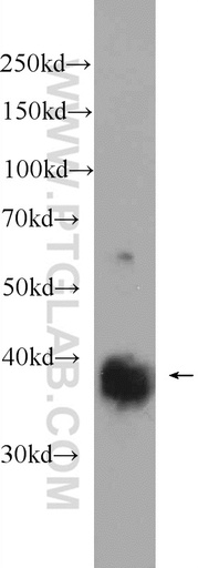 [25371-1-AP-20UL] REM2 Polyclonal antibody